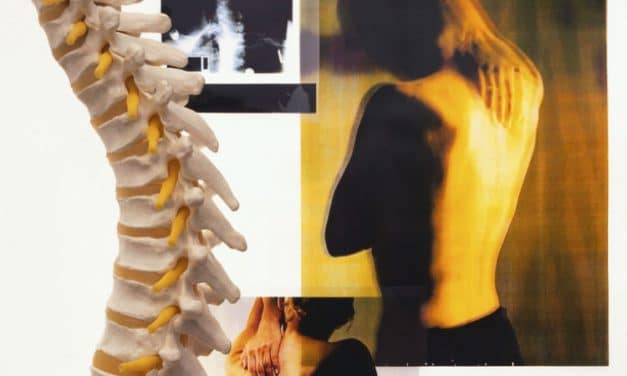Chiropractic Treatment for Spinal Disorders
